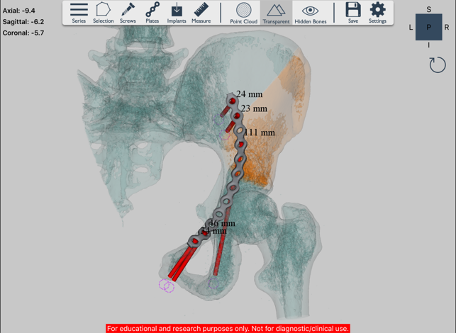 Ossa 3D(圖3)-速報App