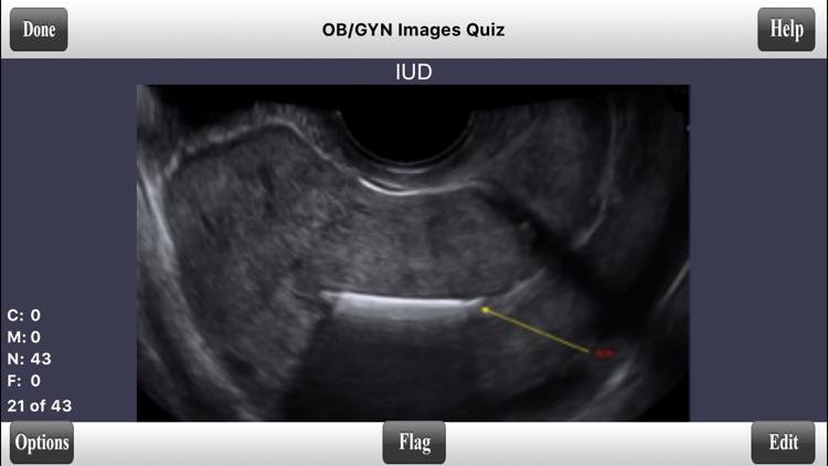 ARDMS OBGYN Ultrasound Flashcards for ARDMS OB/GYN Board Review screenshot-3