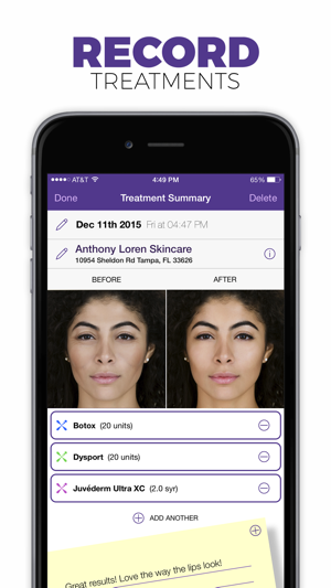 Gotox: Cosmetic Treatment Tracker.