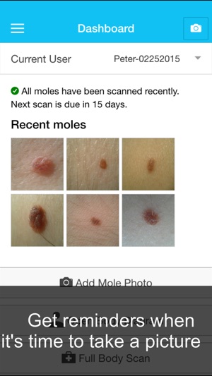 Skin Cancer App - MySkinPal - Map your skin moles(圖4)-速報App