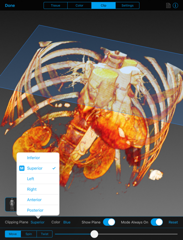 BodyViz screenshot 4