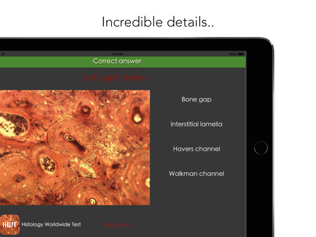 Histology Worldwide Test Lite for iPad(圖3)-速報App