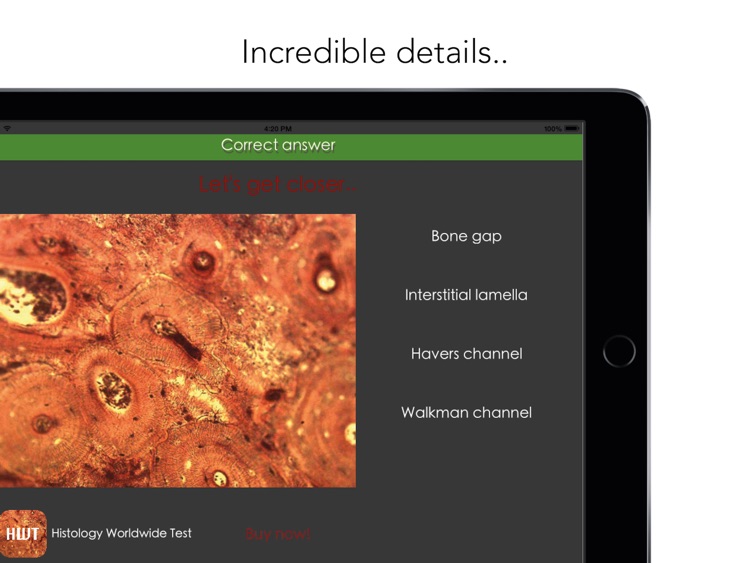 Histology Worldwide Test Lite for iPad