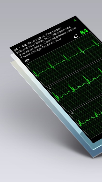 ECG Books - Cardiology Textbooks and Examples screenshot-4