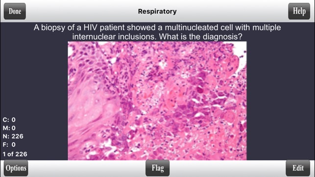 USMLE Step 2 CK Flashcards Lite