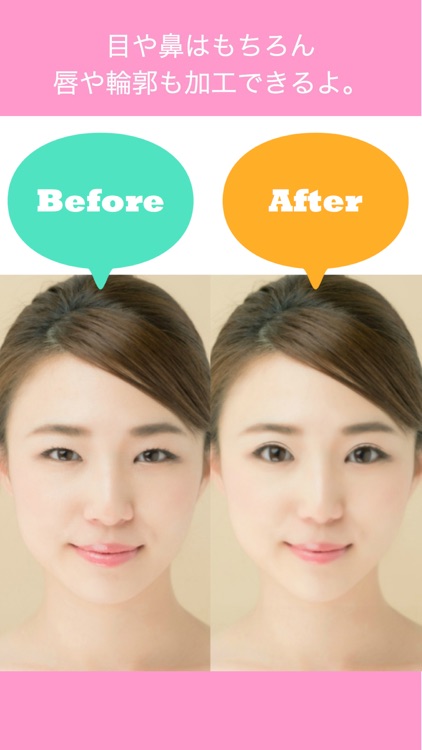 整形シミュレーション　Produced by 湘南美容外科クリニック