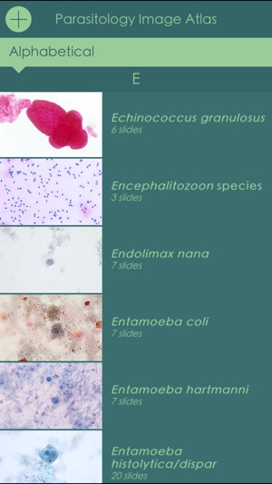 Parasitology Image Atlas(圖4)-速報App