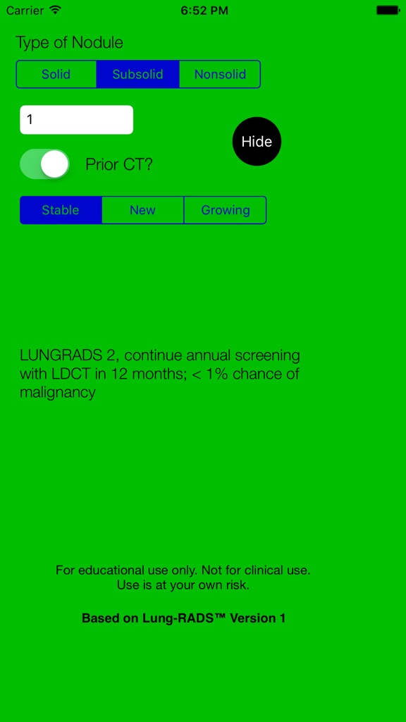 【图】Single Nodule Lung Cancer Screening with Lung-RADS(截图1)