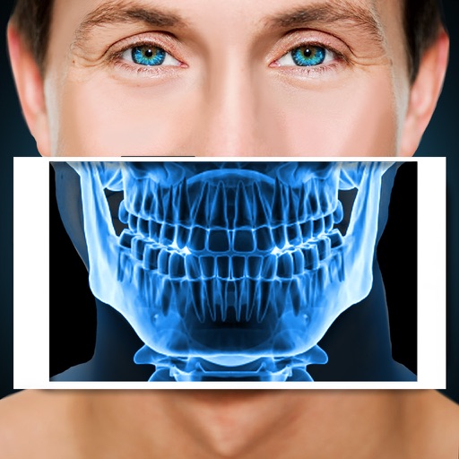 Xray Scanner Teeth Prank iOS App