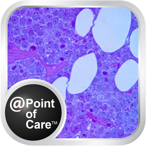 Mieloma Múltiple @Point of Care™ iOS App