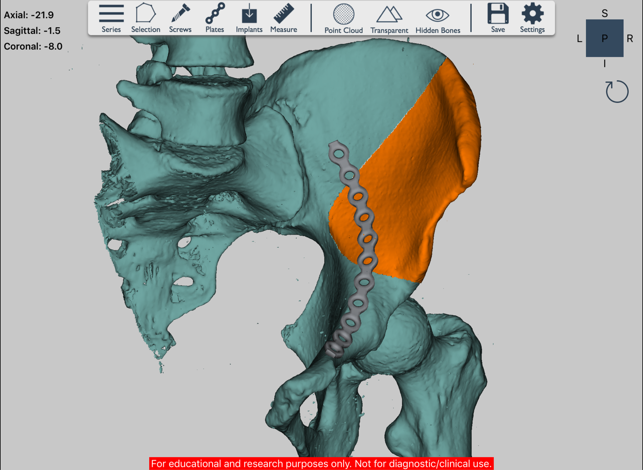 Ossa 3D(圖1)-速報App