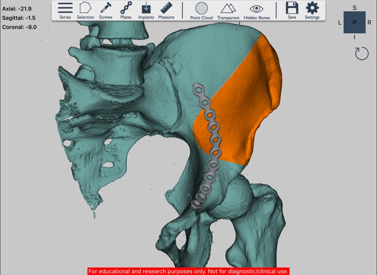 Ossa 3D