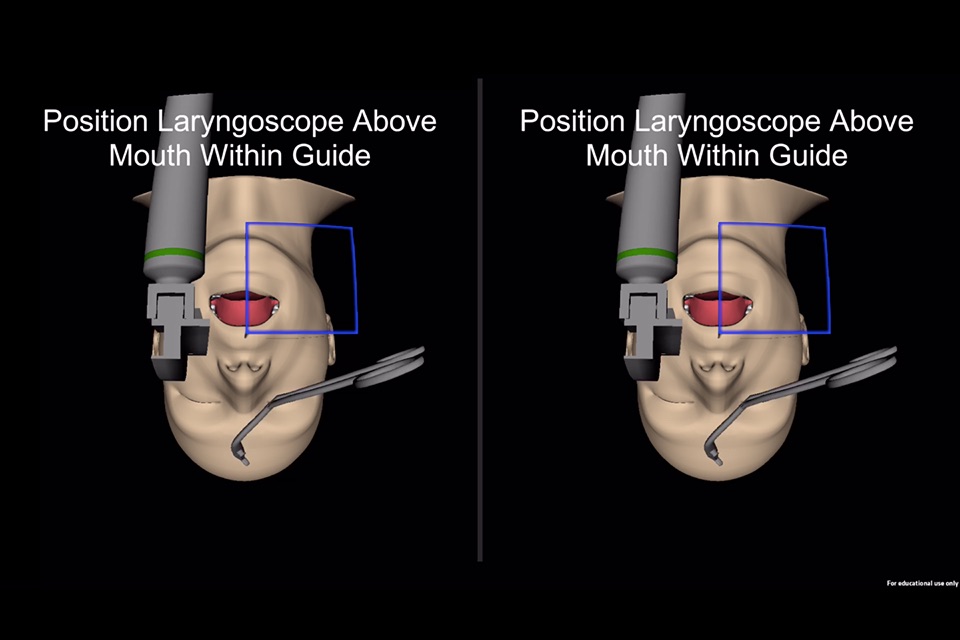 Laryngoscopy AR screenshot 2