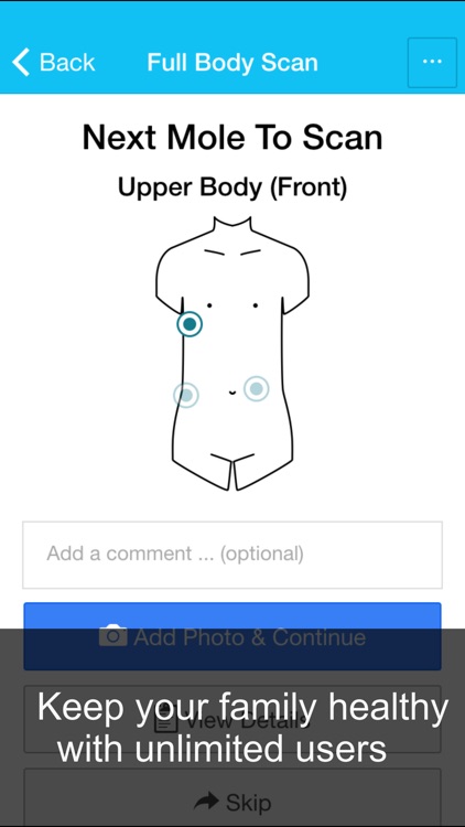 Skin Cancer App - MySkinPal - Map your skin moles