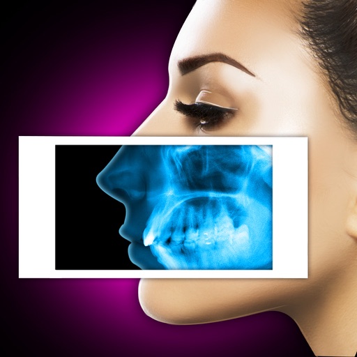 Xray Scanner Nose Prank iOS App