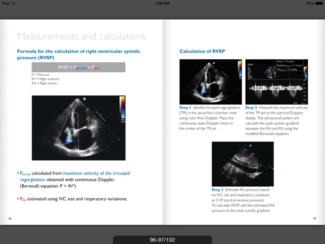 Ultrasound POC Education - Philips(圖3)-速報App