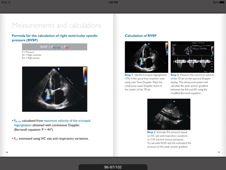 Ultrasound POC Education - Philips