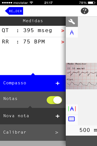 ECG Camera screenshot 2