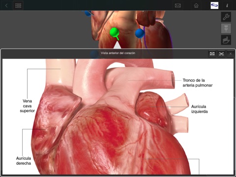 3D Hipertensión e hipercolesterolemia screenshot 3