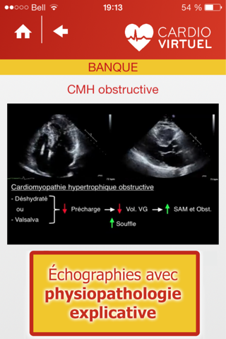 Cardio Virtuel présenté par des médecins spécialistes de l'Université Laval screenshot 4