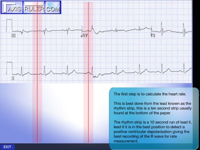 ECG Genius(圖4)-速報App