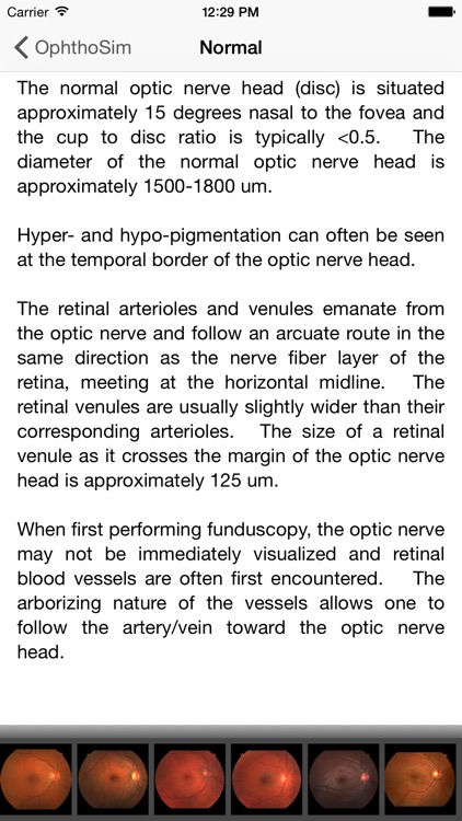 OphthoSim Companion