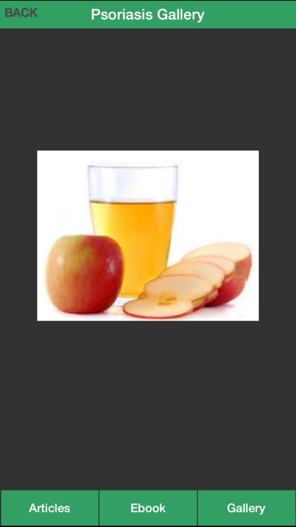 Psoriasis Guide - Learn How to Treat Your Psoriasis Naturally! screenshot-3