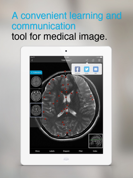 Medical Imaging