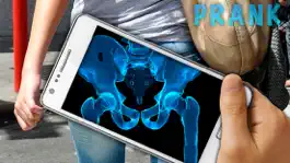 Game screenshot Simulator X-Ray Hip Bone apk