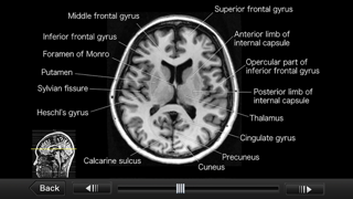 Interactive CT and MRI Anatomy Screenshot 5