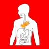 Acid Reflux Guides - Fact & Causes of Acid Reflux Symptoms, Home Remedies for Acid Reflux & Heartburn