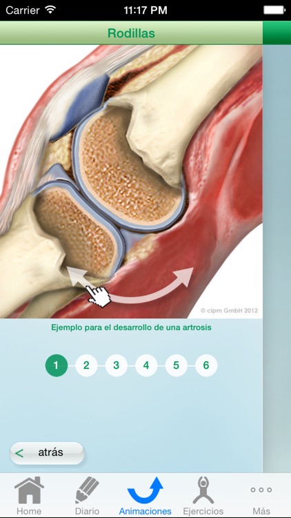 Diario de artrosis CO