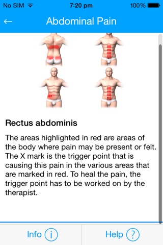 Muscle Trigger Points Massage Therapy screenshot 4