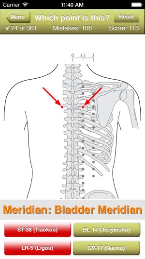 Acupuncture Points Quiz(圖3)-速報App