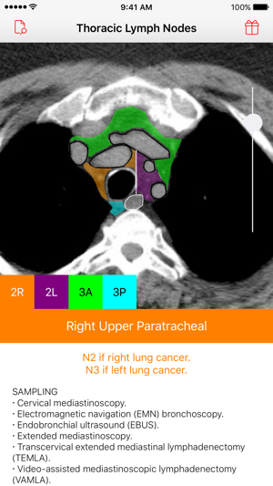 Thoracic Lymph Node Map(圖2)-速報App