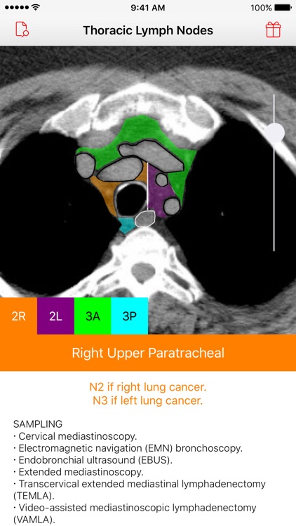 Thoracic Lymph Node Map