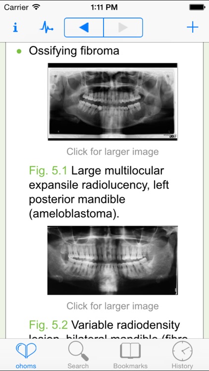 Oxford Handbook of Oral and Maxillofacial Surgery