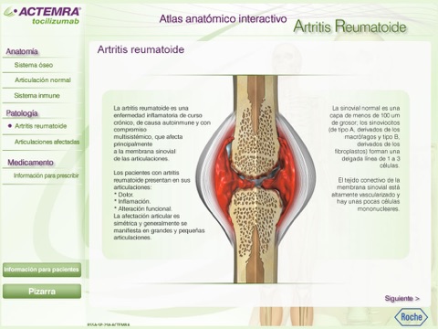 Atlas Artritis Reumatoide screenshot 2