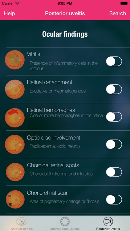Uveitis doctor screenshot-0