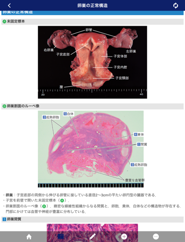 正常画像と比べてわかる病理アトラス Lite版のおすすめ画像1