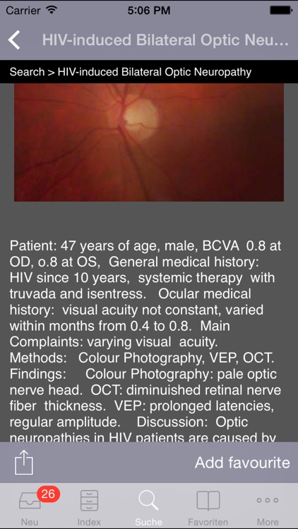 Atlas of Ophthalmology screenshot-4