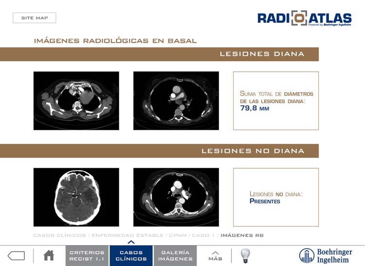 Radioatlas