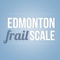 The Edmonton Frail Scale is a tool to be used by the health professionals that help to easely assess the state of frailty of the older patients