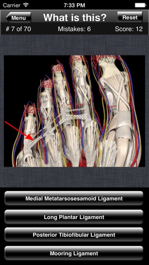 Anatomy Foot Quiz(圖2)-速報App