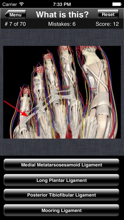 Anatomy Foot Quiz