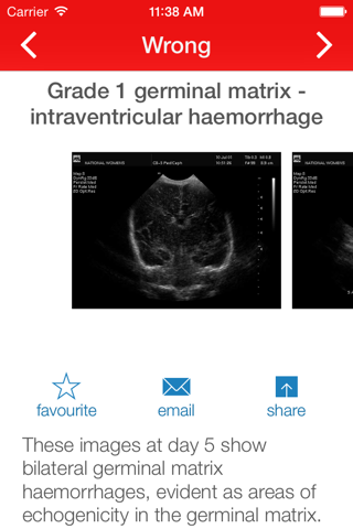 Cranial Ultrasound screenshot 4