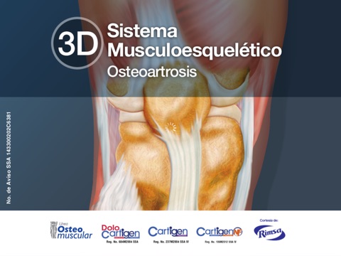 3D Osteoartrosis screenshot 4