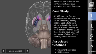 How to cancel & delete 3D Brain from iphone & ipad 3