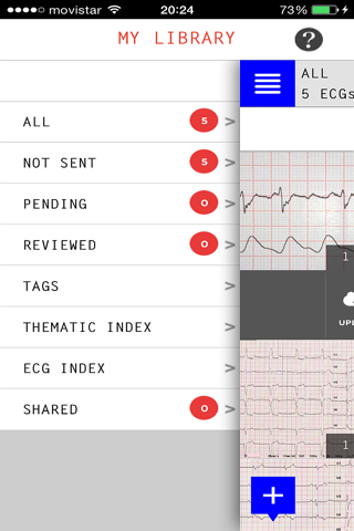 ECG Camera screenshot 2