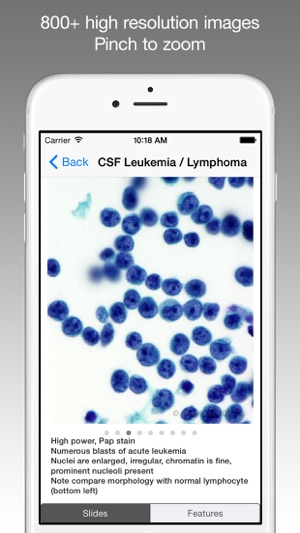 CytoAtlas